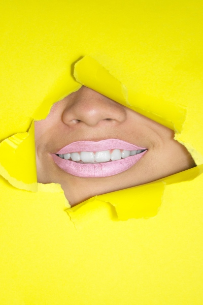 blanchiment-dentaire-rennes-cesson-sevigne-biotizen-institut